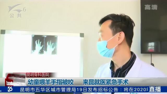 幼童喂羊手指被咬 来昆就医紧急手术