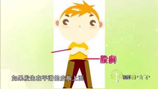 70%80%的成年人都有脚气,什么是脚气?专家现场给出明确回答!