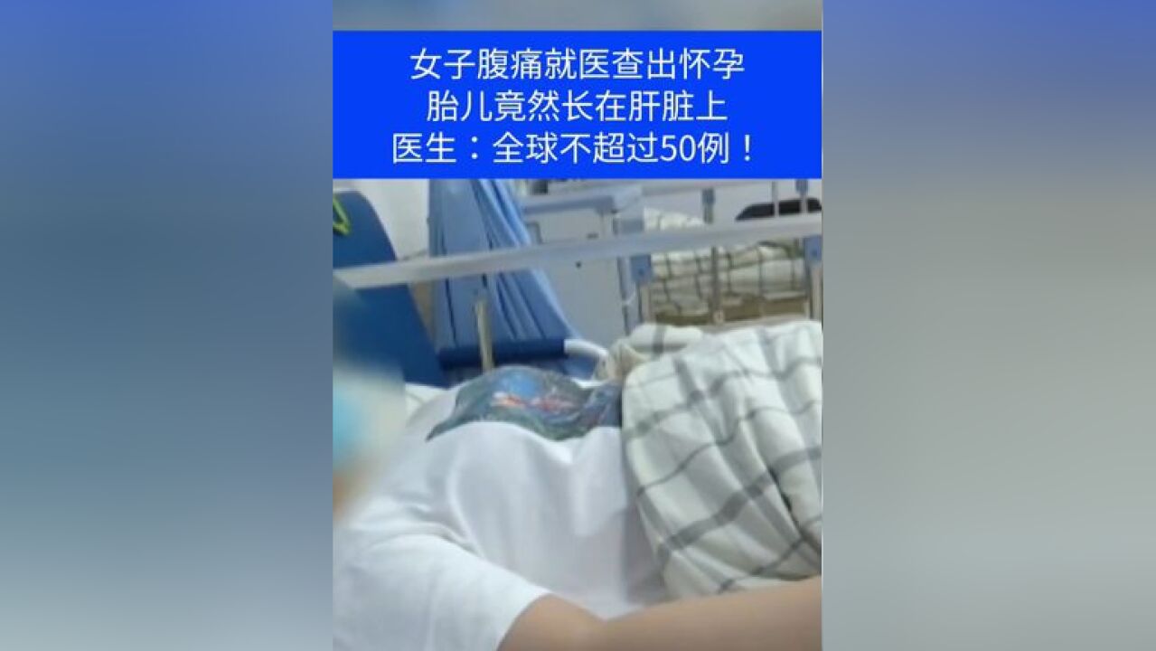 女子腹痛就医查出怀孕,胎儿竟然长在肝脏上,医生:全球不超过50例