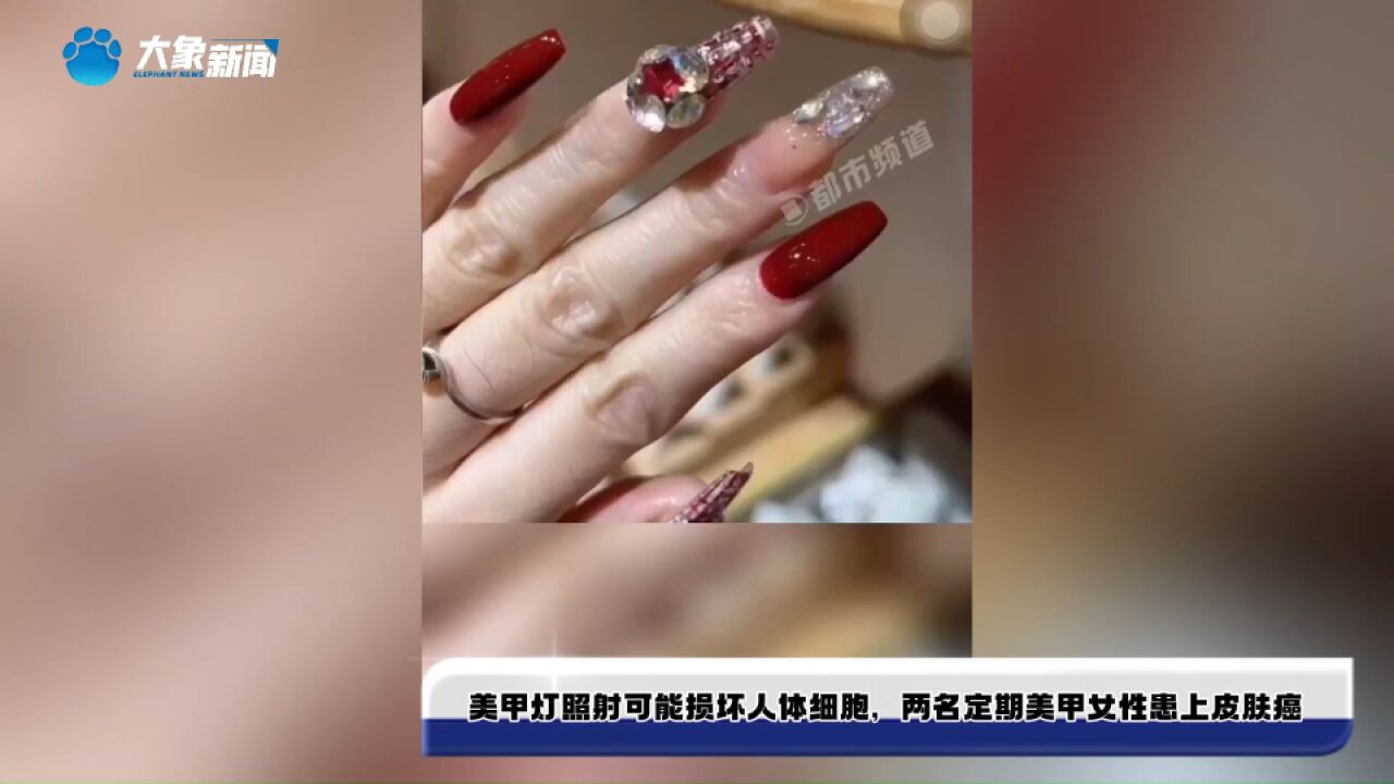 美甲灯照射可能损坏人体细胞,两名定期美甲的女性患上皮肤癌