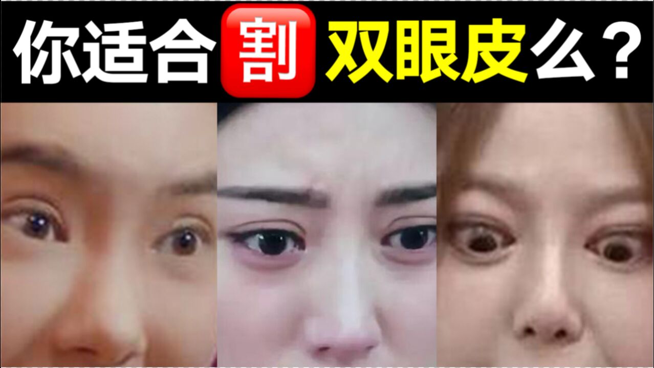 为什么双眼皮失败率那么高?你适合do双眼皮吗?