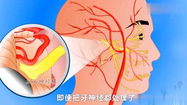 牙疼还认为是上火?其实这些才是真相啊!