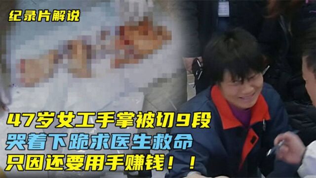 47岁女工手掌被切9段,哭着跪求医生接断指,只因还要用手赚钱!