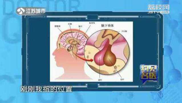 眼睛没问题但视野变窄、余光看不清?当心垂体瘤找上门!