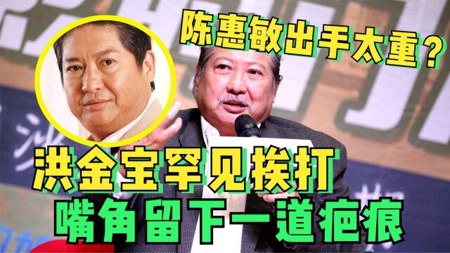 洪金宝嘴角的疤哪来的?传说惹恼陈惠敏,洪金宝至今不愿提起