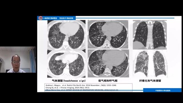 IPF与NSIP、cHP的鉴别诊断宁夏医科大学总医院朱力