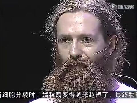 TED演讲:避免衰老的7个方面