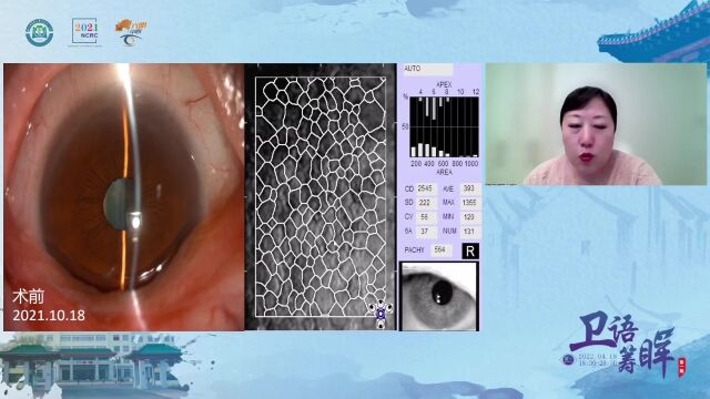 4.18 卫语筹眸第一期 