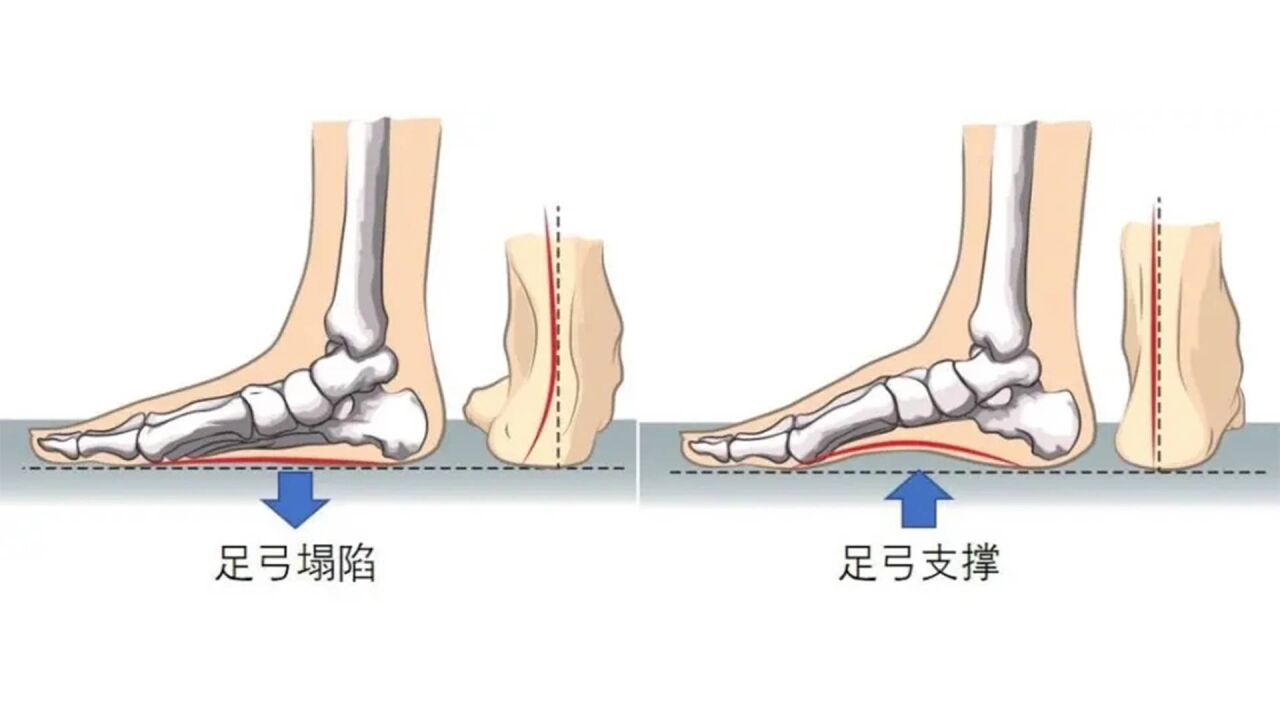 足弓训练奇效:塑腿型+瘦腿,想要腿好看,足弓一定练