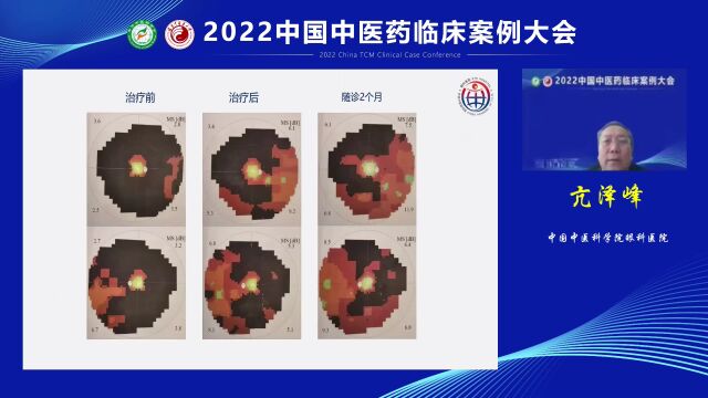 观看量超78万:2022中国中医药临床案例大会成功举办!(中篇)