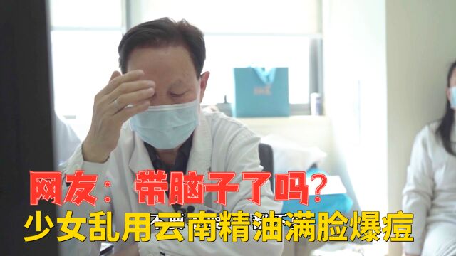 少女乱用云南精油爆痘,现场一人单挑全诊室,网友:带脑子了吗?