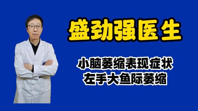 小脑萎缩表现症状:左手大鱼际虎口萎缩怎么办?