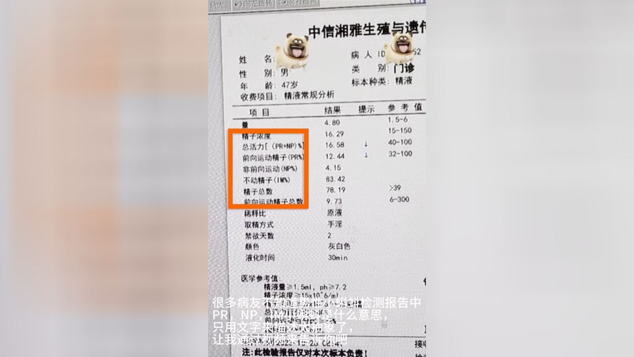 PR、NP、IM小蝌蚪是什么意思?这段视频告诉你答案