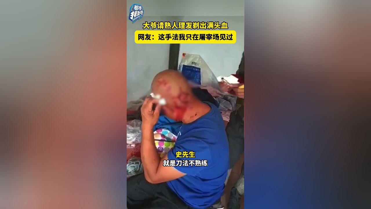 大爷请熟人理发剃出满头血 网友:这手法我只在屠宰场见过