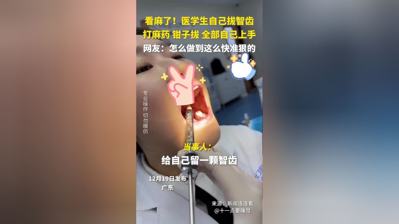 医学生自己拔智齿,打麻药、钳子拔,全部自己上手!网友:怎么做到这么快准狠的?