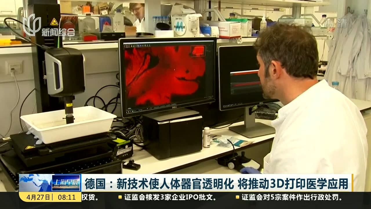 德国:新技术使人体器官透明化 将推动3d打印医学应用