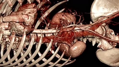 【戒色视频22】不净观略述