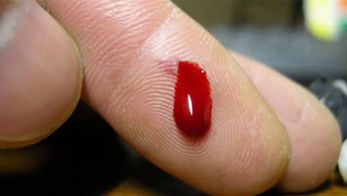 手指被划破流血,含在嘴里用唾液消毒,这样科学吗?