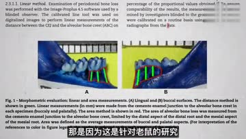研究发现：吃植物性饮食能改善牙周病