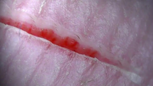 腾讯视频