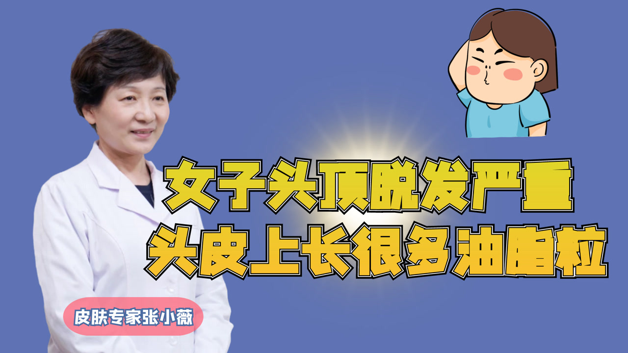女子头顶脱发严重,头皮上长很多油脂粒.