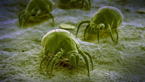 原来人脸上有4000多只螨虫 显微镜下看一看吓了一跳