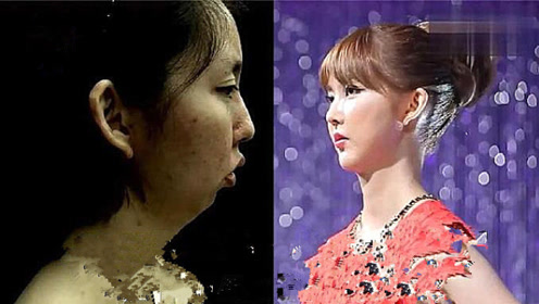 没有下巴的女子,脖子几乎连着嘴巴,医生:从未见过这样的下巴!
