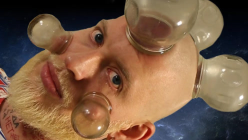 战斗民族在脸上拔火罐,网友:偷学技术不到家,要人命!