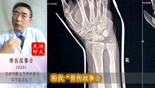 腕舟骨骨折 腾讯视频