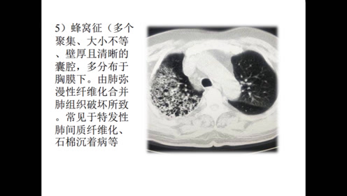 放射线画法 腾讯视频