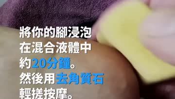 脚底龟裂怎么预防？