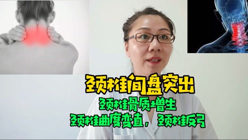 颈椎突出 腾讯视频