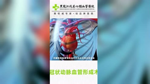 冠状动脉 腾讯视频