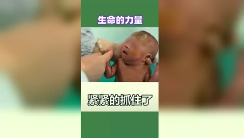 干瘪的28周早产儿 腾讯视频