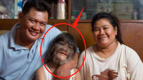 1920年印度发现两个"狼孩",被人带回孤儿院,后来她们怎么样了?