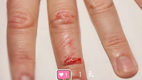 间:2021-11-24上传者:探纪自然0:02:22如何愈合肛瘘伤口,名医真人实验