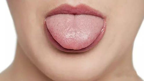 舌头是人体健康的放大镜 你也"照照"吧
