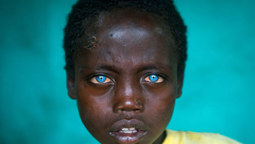 上帝遗忘的天使!上天给他一双美丽的蓝宝石眼睛,没想却被人嫌弃