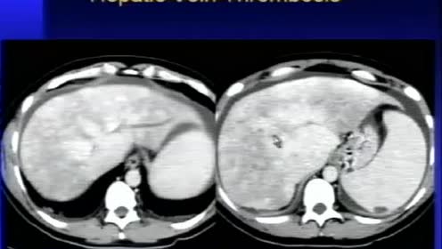 61 Focal and Diffuse Hepatic Disease