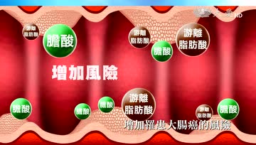 预防大肠癌：除了肉类，还有两类食品要少吃