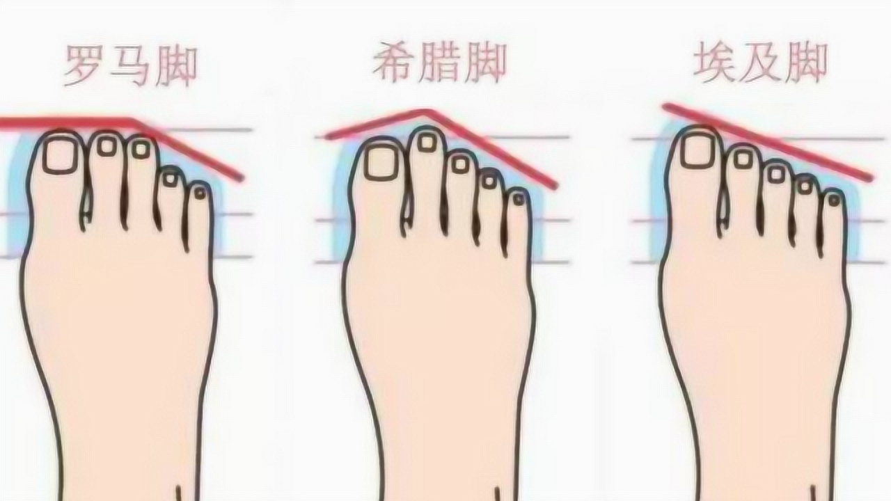 罗马脚 脚的形状 搜狗百科