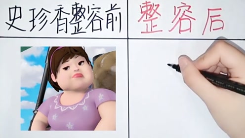 史珍香整容前vs整容后,反差太大了!判若两人