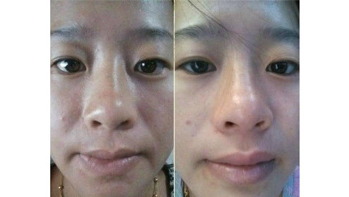 怎样才能去掉脸上的斑?祛斑小窍门来告诉你如何祛斑