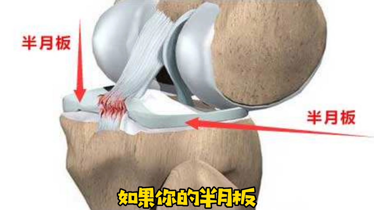 半月板 构成膝关节的重要结构 搜狗百科