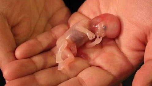 意外怀孕后,堕胎流产的婴儿如何处理的?看完泪奔