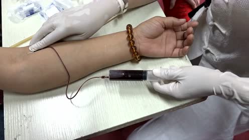 中医针灸视频李松芝放血疗法肘部放血实操演示