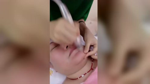 去黑头最好的品牌 腾讯视频