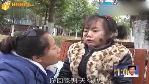 兽皮痣 腾讯视频