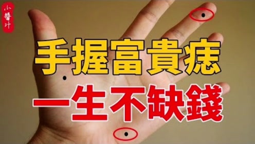 命理运势:"手上有痣,富贵一世",手里那些多财多福的痣相!