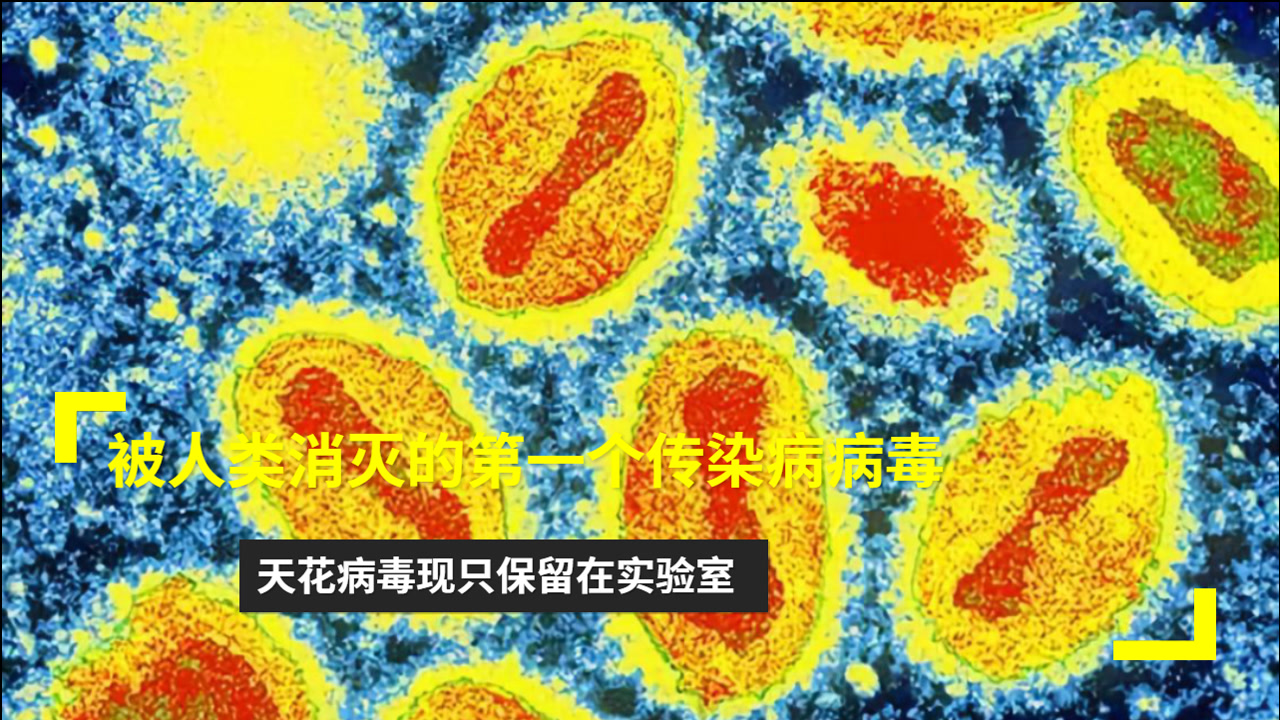 天花病毒(烈性传染病)_搜狗百科